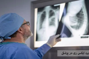 کاربرد ایکس ری در پزشکی