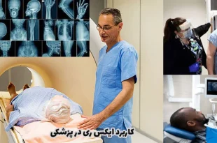 کاربرد ایکس ری در پزشکی