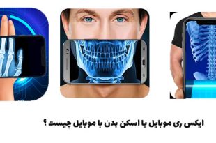 ایکس ری موبایل